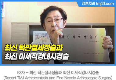 �ֽ� �ΰ������������ֽ� �̼����泻�ð��